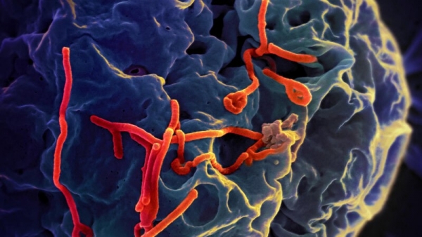 Bộ Y tế thông tin diễn biến phức tạp của dịch bệnh do virus Ebola