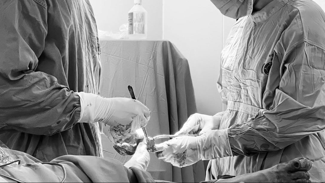 Bệnh viện K phẫu thuật thành công cho 2 anh em sinh đôi mắc bệnh hiếm gặp với hàng trăm khối u trên cơ thể