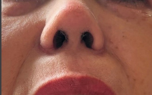 “Được” chủ nhà nâng mũi sau khi học cấp tốc 3 ngày!