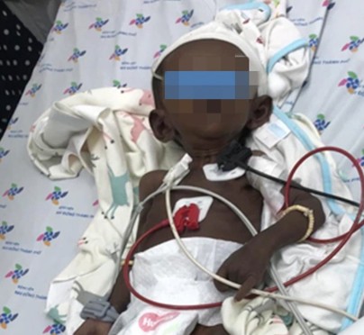 Căn bệnh khiến da bé gái đen sậm