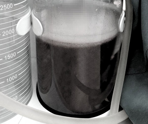 'Nâng cấp mông' cấp tốc bằng tiêm filler, người phụ nữ phải nhập viện