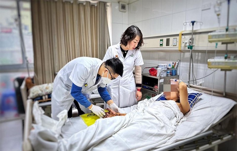 Bệnh nhân vào viện vì tai nạn pháo tự chế dịp Tết Quý Mão điều trị tại Bệnh viện Việt Đức. Ảnh: BVCC