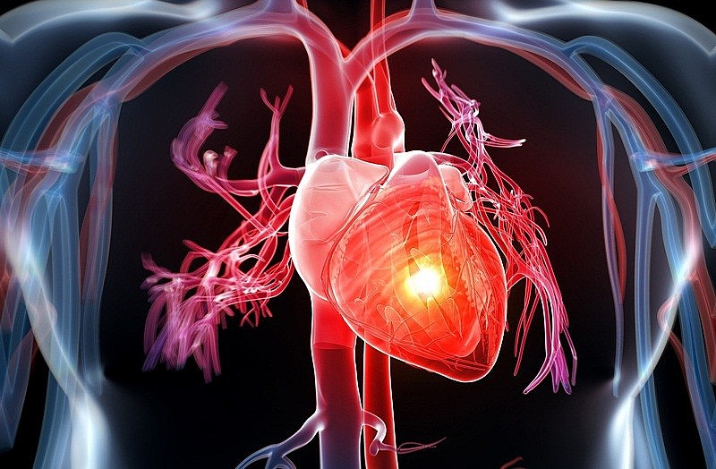 Những điều quan trọng bạn cần biết về bệnh tim mạch
