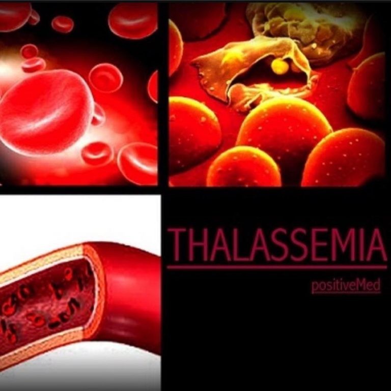 Ông Tôn Thất Dũng chữa bệnh tan máu bẩm sinh (Thalassemia) bằng cả con tim và tấm lòng của người làm thuốc