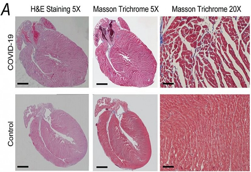 Hình ảnh tim của những con chuột bị nhiễm COVID-19 cho thấy tỷ lệ xơ hóa và giãn nở các sợi tăng lên. Đây là một dấu hiệu phổ biến của bệnh cơ tim sớm ở chuột. Ảnh: Andrew Marks/ https://suckhoeviet.org.vn/