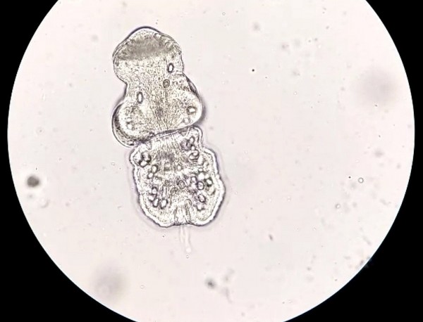 Ghi nhận ca bệnh thứ 2 ở Việt Nam có sán chó trong tim