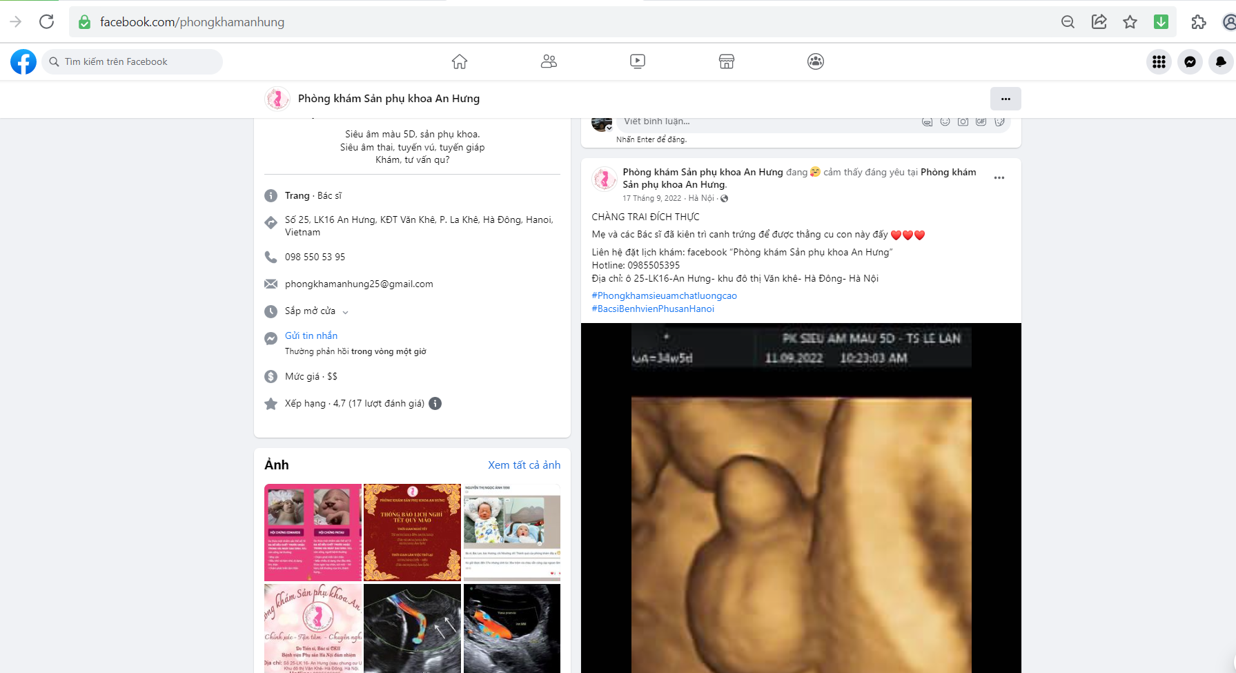 Phòng khám phụ sản An Hưng vô tư tiết lộ giới tính thai nhi trái quy định: Sở Y tế Hà Nội cần vào cuộc