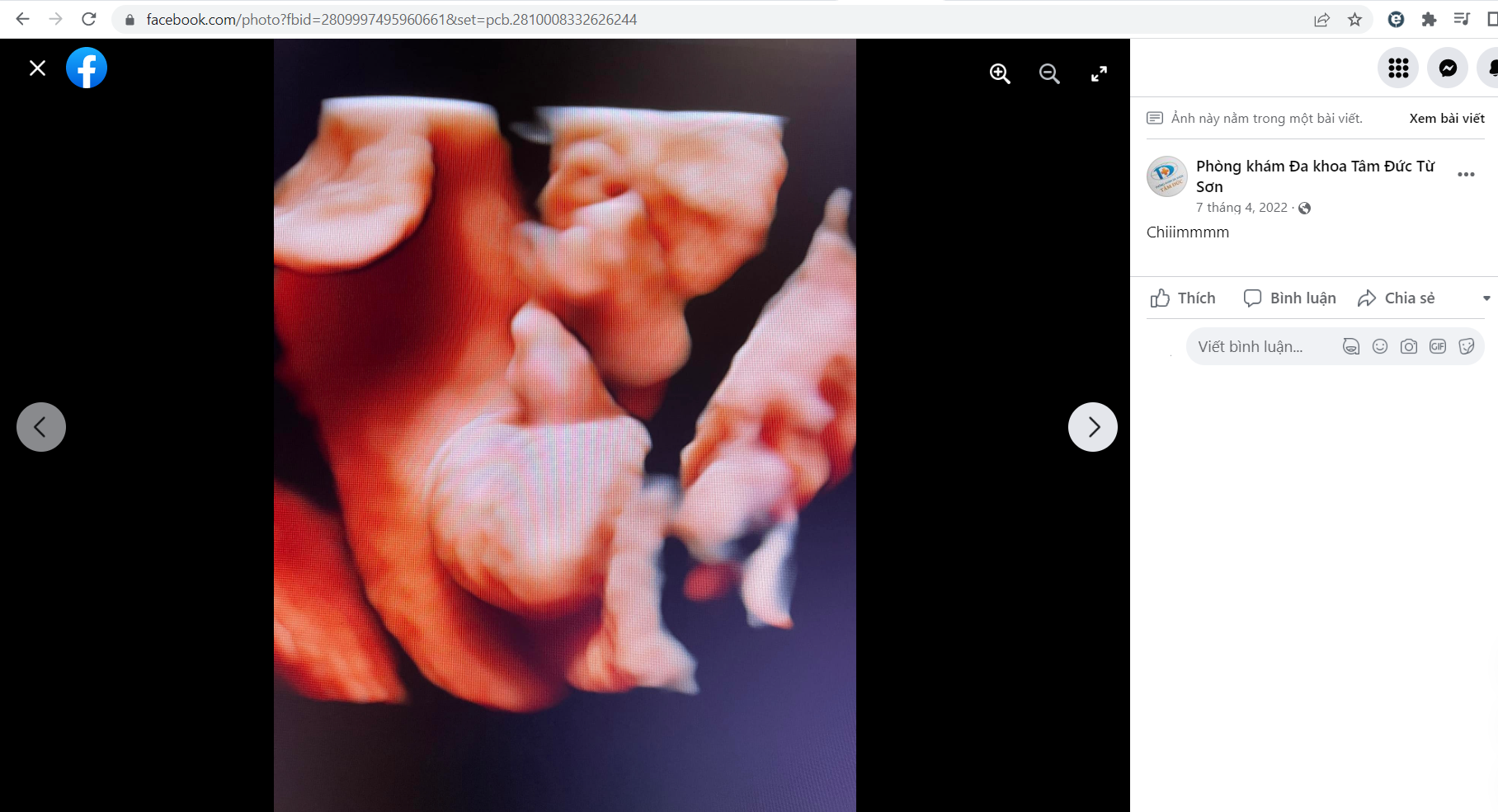 Bắc Ninh: Phòng khám đa khoa Tâm Đức Từ Sơn vi phạm pháp lệnh dân số Bắc Ninh: Phòng khám đa khoa Tâm Đức Từ Sơn vi phạm pháp lệnh dân số