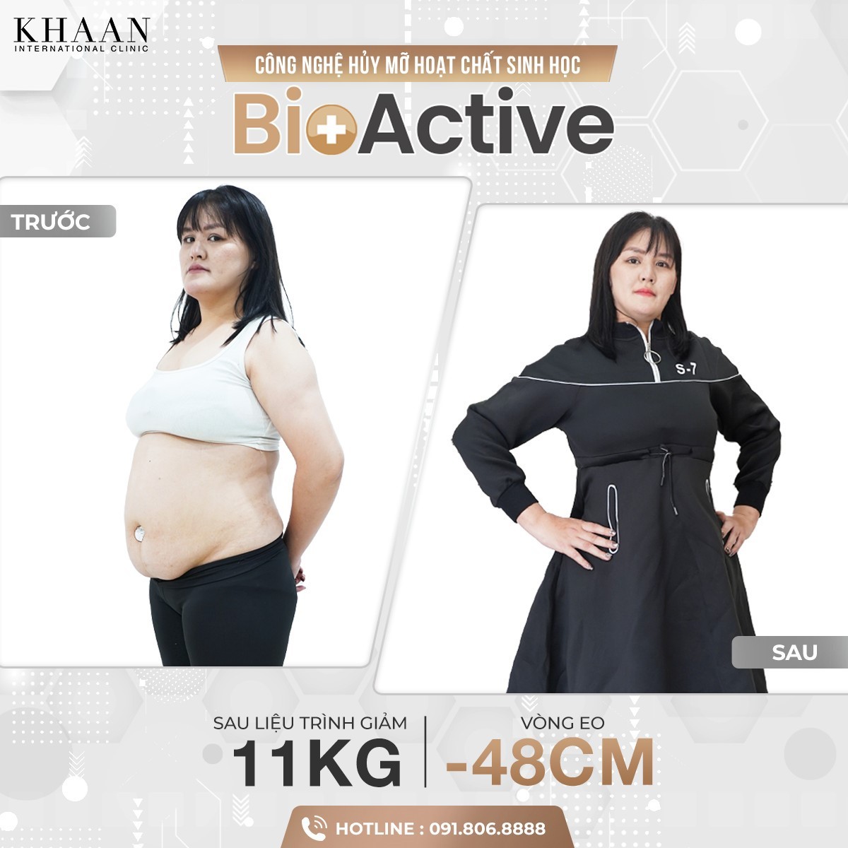 Sự khác biệt giữa hủy mỡ hoạt chất sinh học Bioactive và những phương pháp giảm béo thông thường