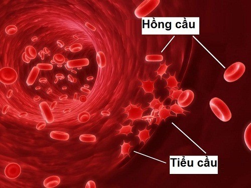 Bệnh tan máu bẩm sinh (Thalassemia) được lương y Tôn Thất Dũng dùng phương pháp y học cổ truyền: “Nam dược trị nam nhân” trong điều trị bệnh