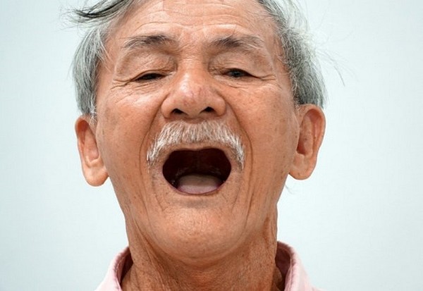 Người già bao nhiêu tuổi thì rụng răng?