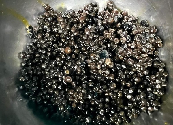 Phát hiện hàng nghìn viên sỏi trong túi mật cụ bà 73 tuổi