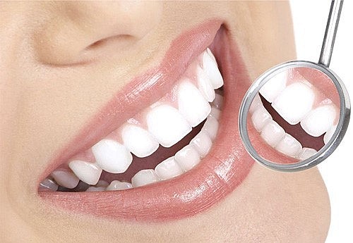 Răng sứ tốt, có nguồn gốc xuất xứ rõ ràng sẽ hạn chế tối đa các biến chứng nha khoa gây hại cho sức khoẻ con người.