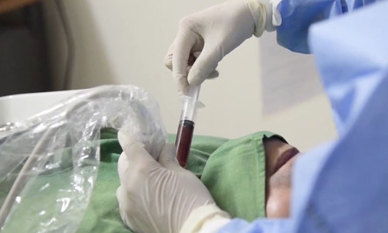 Cẩn trọng tiêm cồn trong điều trị u tuyến giáp