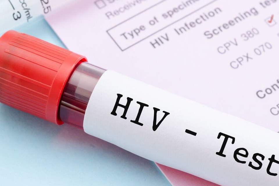 Điều kiện xác nhận người bị phơi nhiễm, nhiễm HIV do tai nạn rủi ro nghề nghiệp