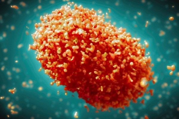 Phát hiện thêm 1 trường hợp mắc bệnh đậu mùa khỉ tại TP HCM