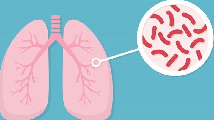 Phát triển một số phương pháp chẩn đoán mới để phát hiện bệnh lao