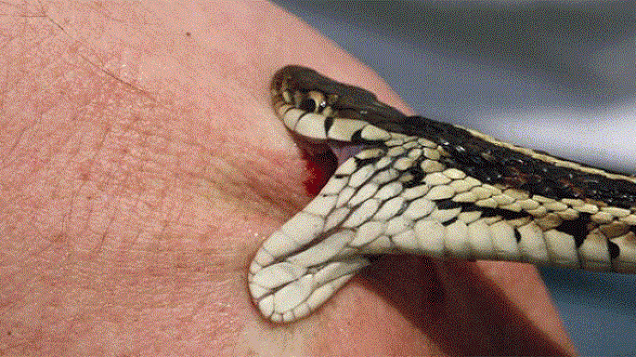 Nghệ An: Cứu sống bé 10 tuổi do đắp thuốc nam chữa rắn cạp nia cắn