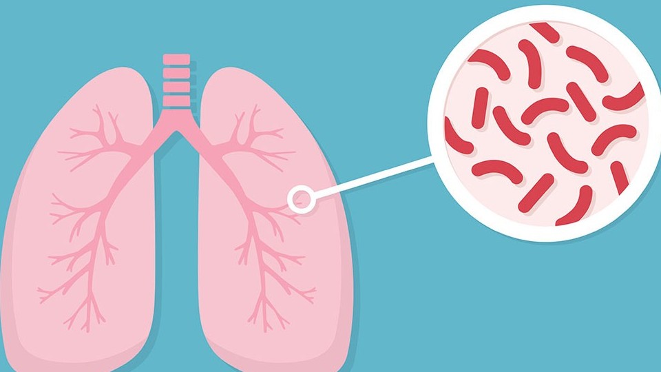 Nâng cấp Hệ thống giám sát và quản lý thông tin bệnh lao