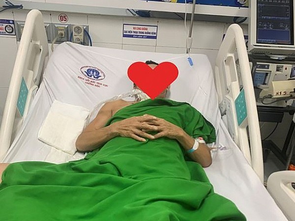 Phú Thọ: Người đàn ông nguy kịch vì giẫm phải đinh gỉ