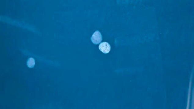 Uống thuốc cam không rõ nguồn gốc, bệnh nhi ngộ độc chì nặng