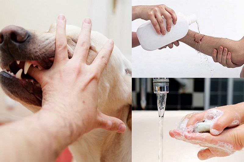 Bộ Y tế khuyến cáo biện pháp để chủ động phòng, chống bệnh dại