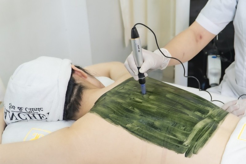 Mách bạn quy trình chuẩn spa trị mụn lưng hiệu quả