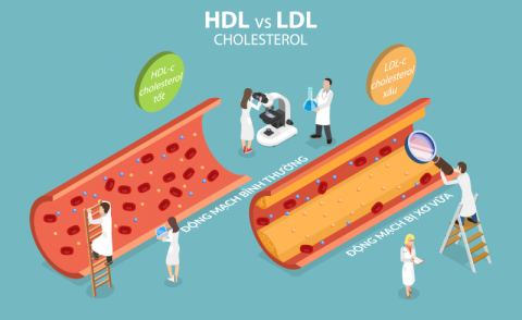 Rối loạn lipid máu: nguyên nhân, biến chứng, điều trị  và phòng ngừa | Bệnh viện Đại học Y Hà Nội