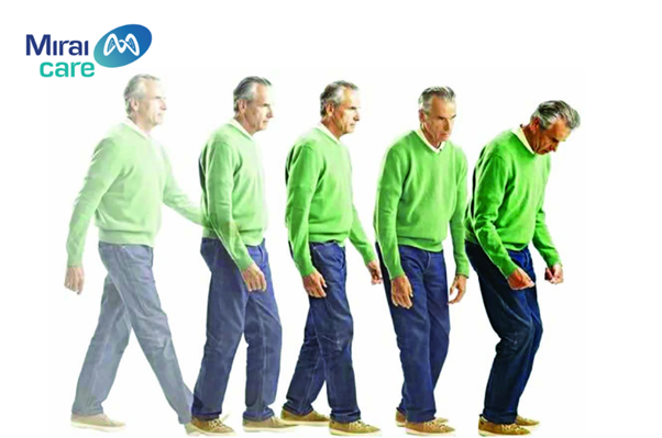 Liệu pháp tế bào gốc mở ra kỷ nguyên mới trong điều trị parkinson