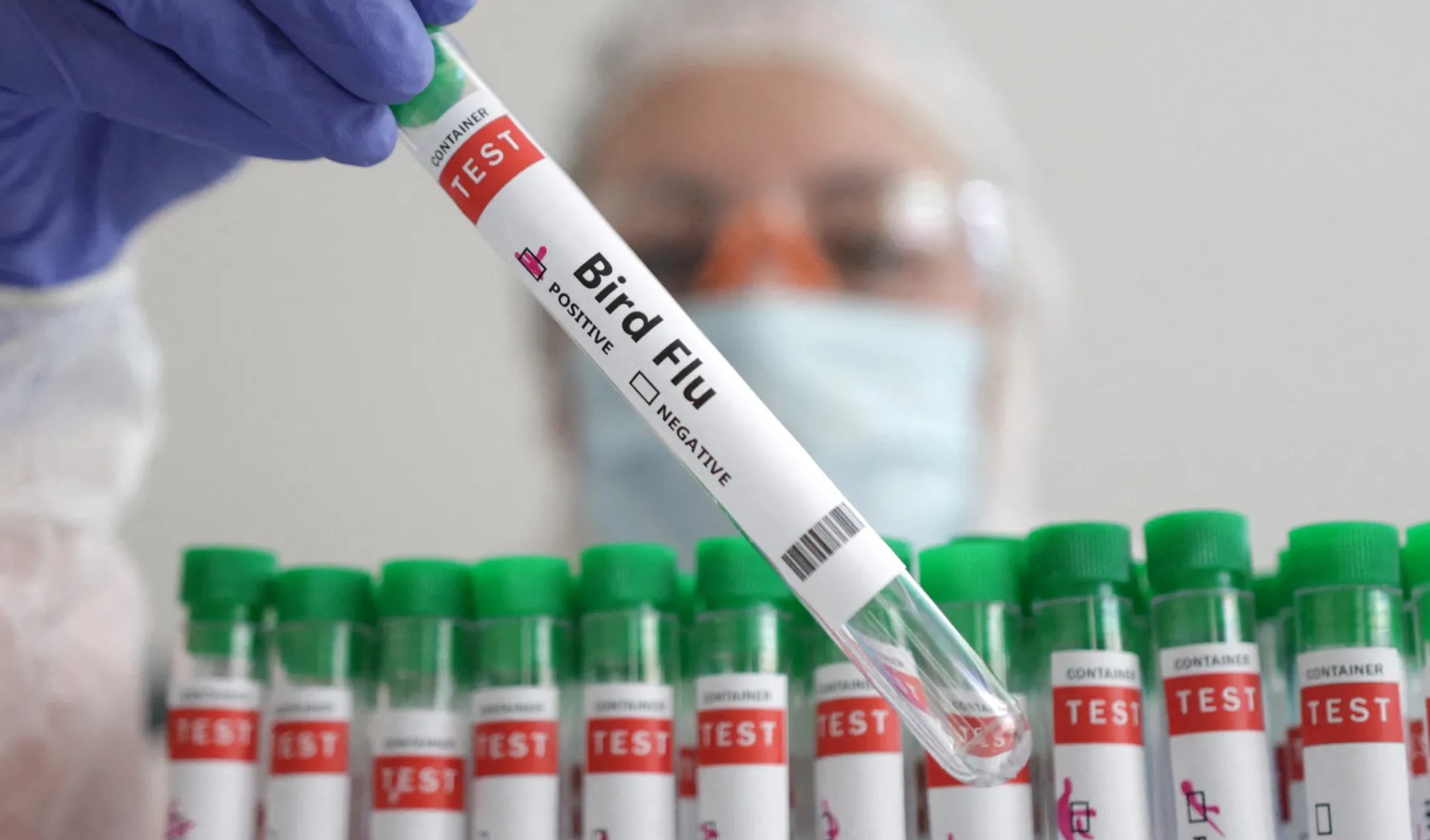 Trường hợp đầu tiên tử vong do nhiễm virus cúm gia cầm H5N2