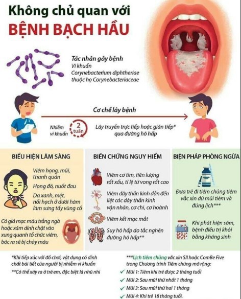 Bộ Y tế chỉ đạo tăng cường phòng, chống bệnh Bạch hầu Bộ Y tế chỉ đạo tăng cường phòng, chống bệnh Bạch hầu