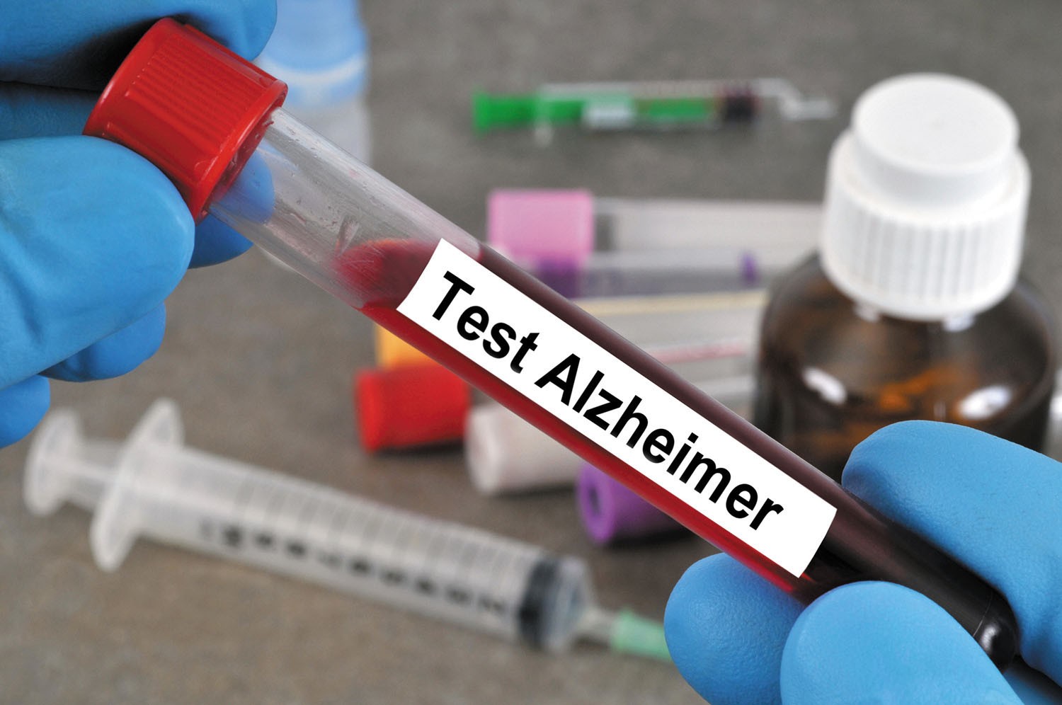 Xét nghiệm máu giúp chẩn đoán bệnh Alzheimer chính xác hơn