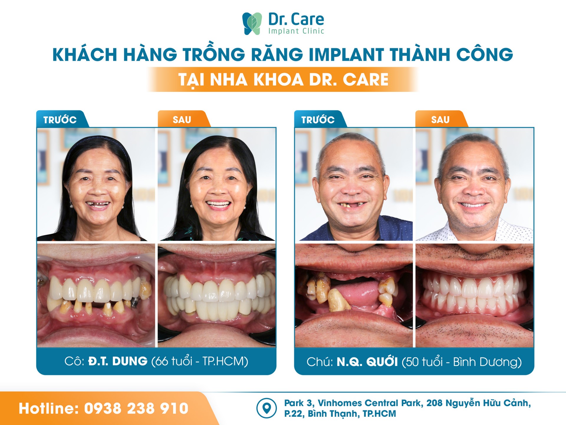 Dr. Care: Nha khoa tiên phong ứng dụng công nghệ cao trong trồng răng Implant