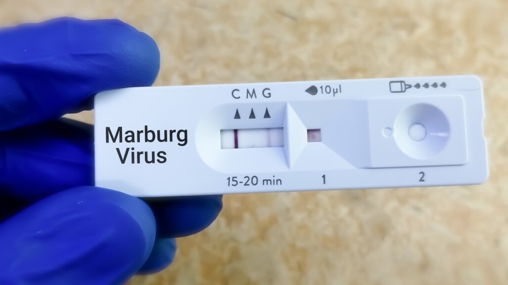 Rwanda thử nghiệm lâm sàng phương pháp điều trị virus Marburg