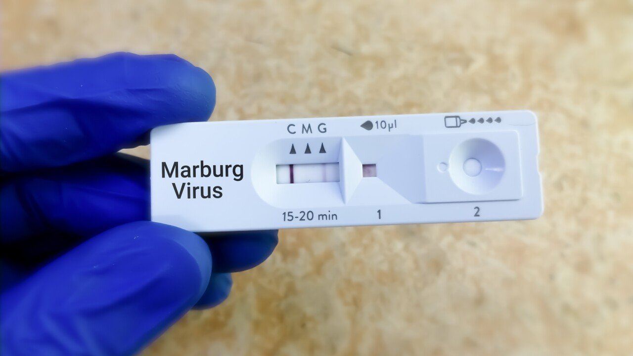 Rwanda thử nghiệm lâm sàng phương pháp điều trị virus Marburg