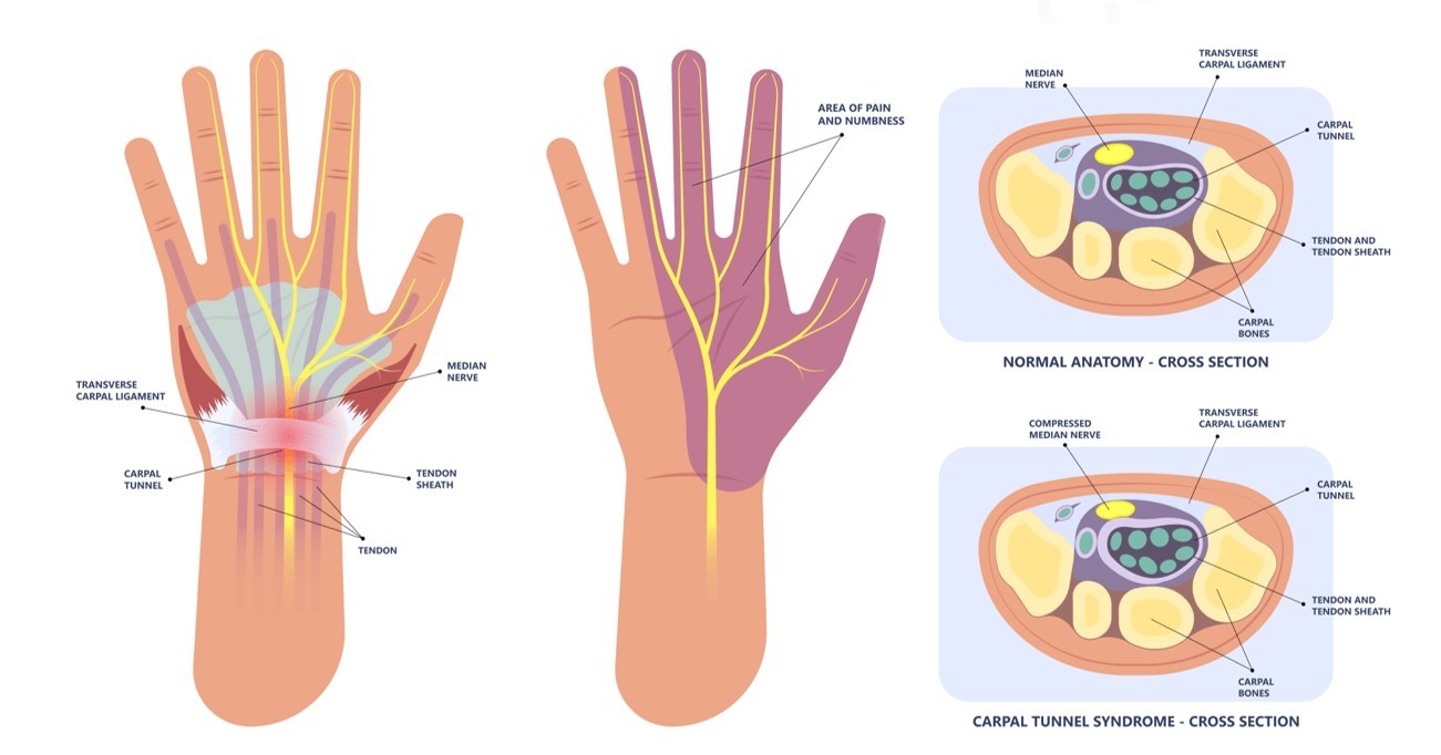 Những nguyên nhân bị cứng khớp khi ngủ và cách khắc phục