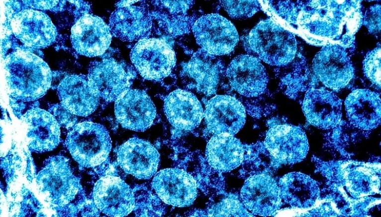 Phát hiện cây hương nhu chứa chất ức chế sự phát triển của virus SARS-CoV-2