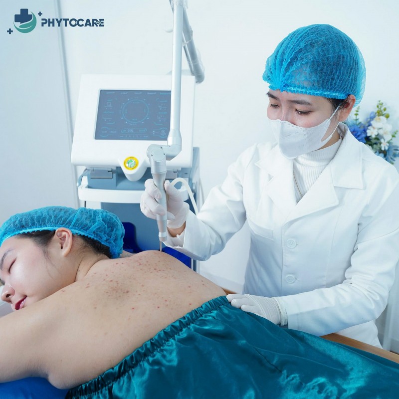 Viêm nang lông sau sinh - Cơn ác mộng của nhiều mẹ bỉm