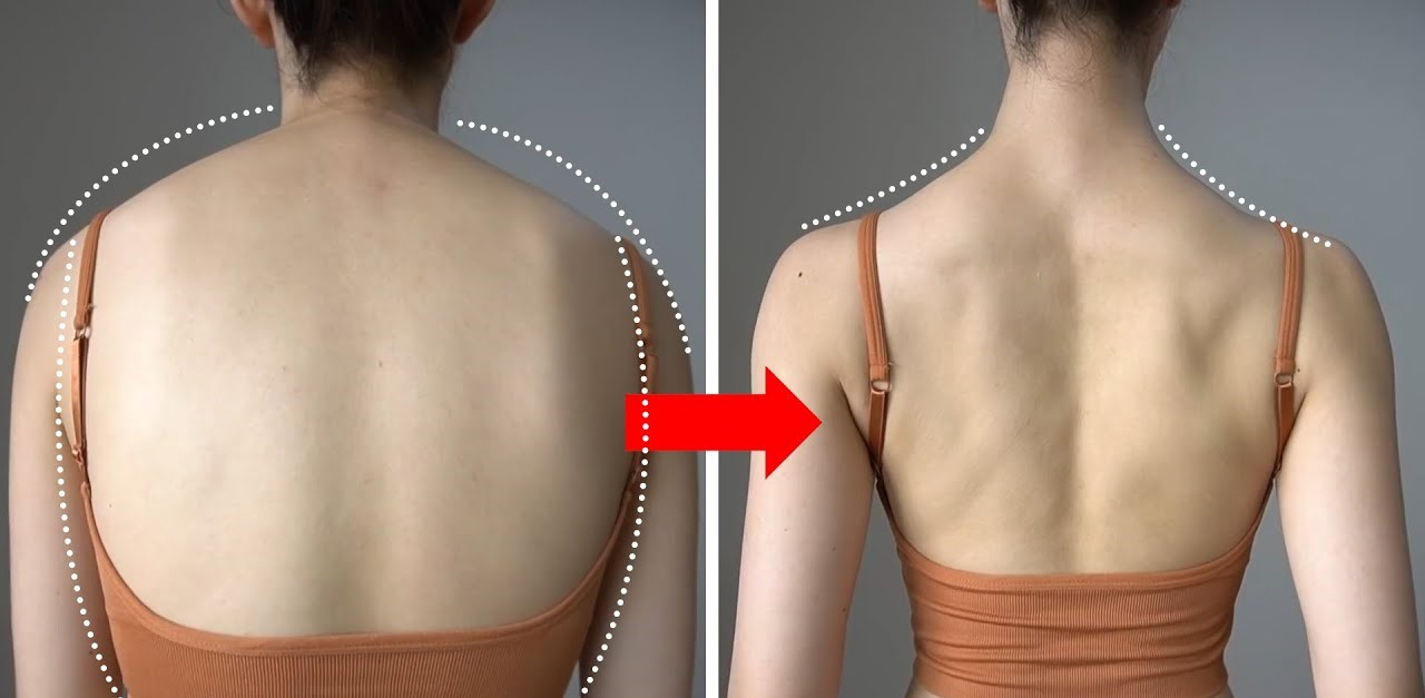 Tập gì để giảm mỡ lưng và vai hiệu quả?