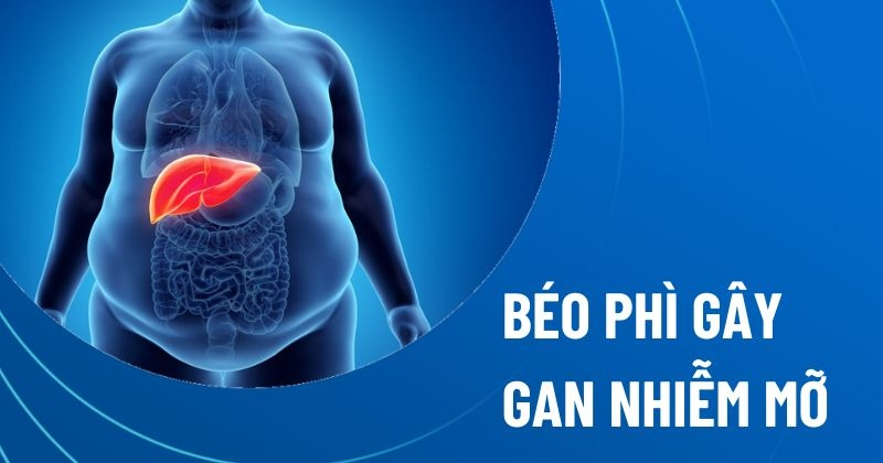 Tình trạng bệnh gan ở người béo phì: Cách khắc phục