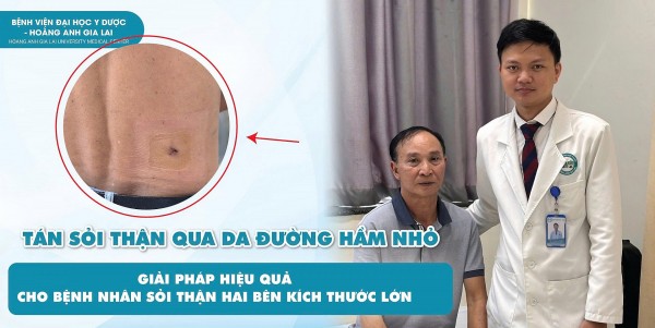 Bệnh viện Đại học Y Dược – Hoàng Anh Gia Lai áp dụng kỹ thuật tiên tiến ít xâm lấn cho bệnh nhân sỏi thận