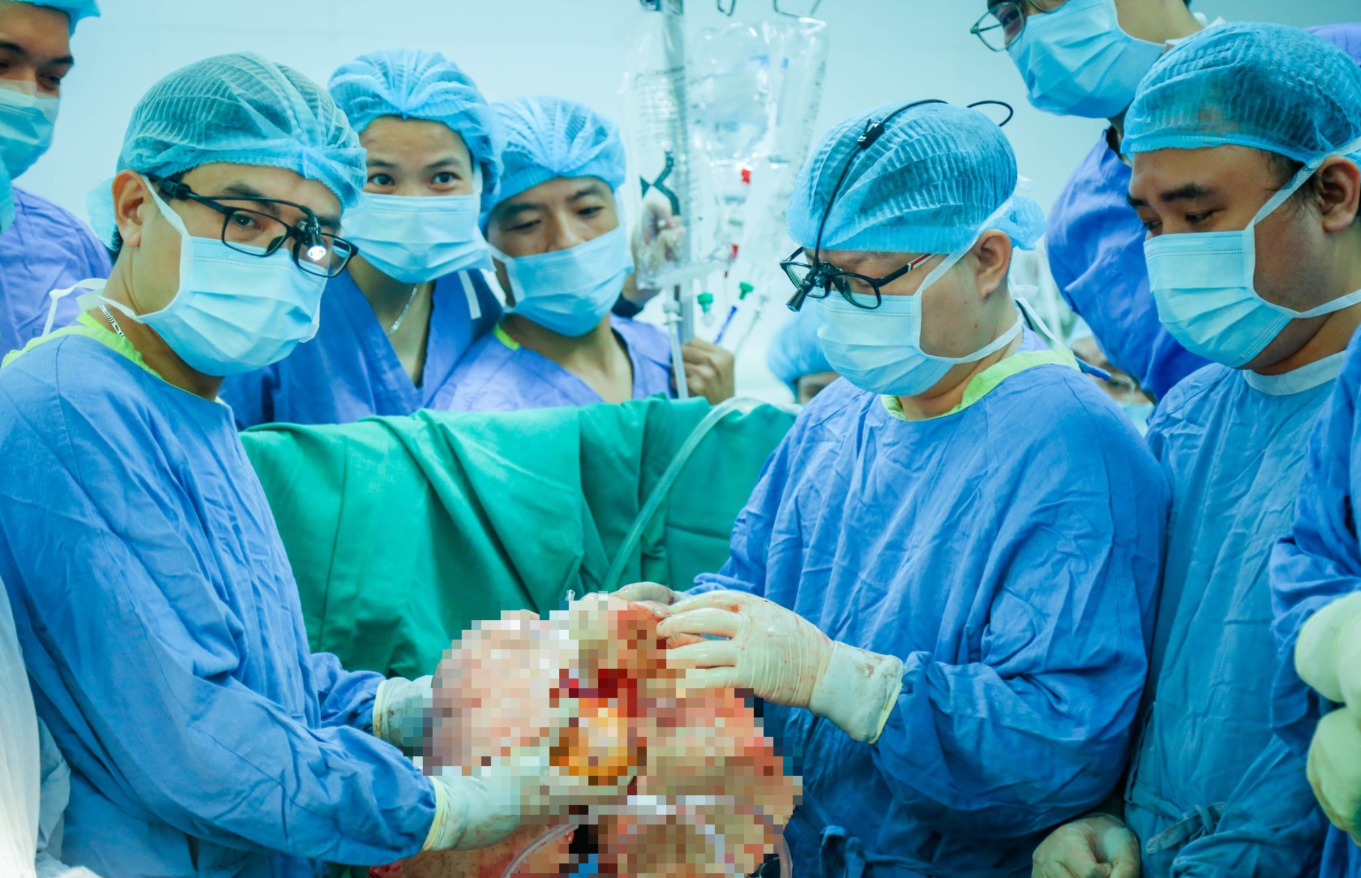 Lần đầu tiên Việt Nam ghép thành công đồng thời tim và phổi cho người suy đa tạng