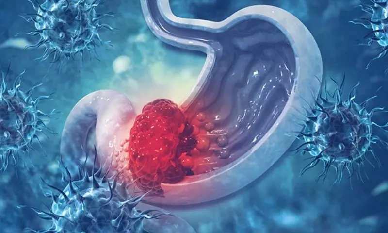 3 dấu hiệu trên mặt cảnh báo ung thư dạ dày