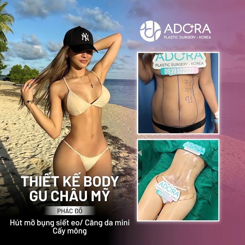 Đẹp An toàn, Tỏa sáng, Bền vững: Bí mật phía sau sự thành công suốt hơn 1 thập kỷ của Adora Plastic Surgery Korea Đẹp An toàn, Tỏa sáng, Bền vững: Bí mật phía sau sự thành công suốt hơn 1 thập kỷ của Adora Plastic Surgery Korea