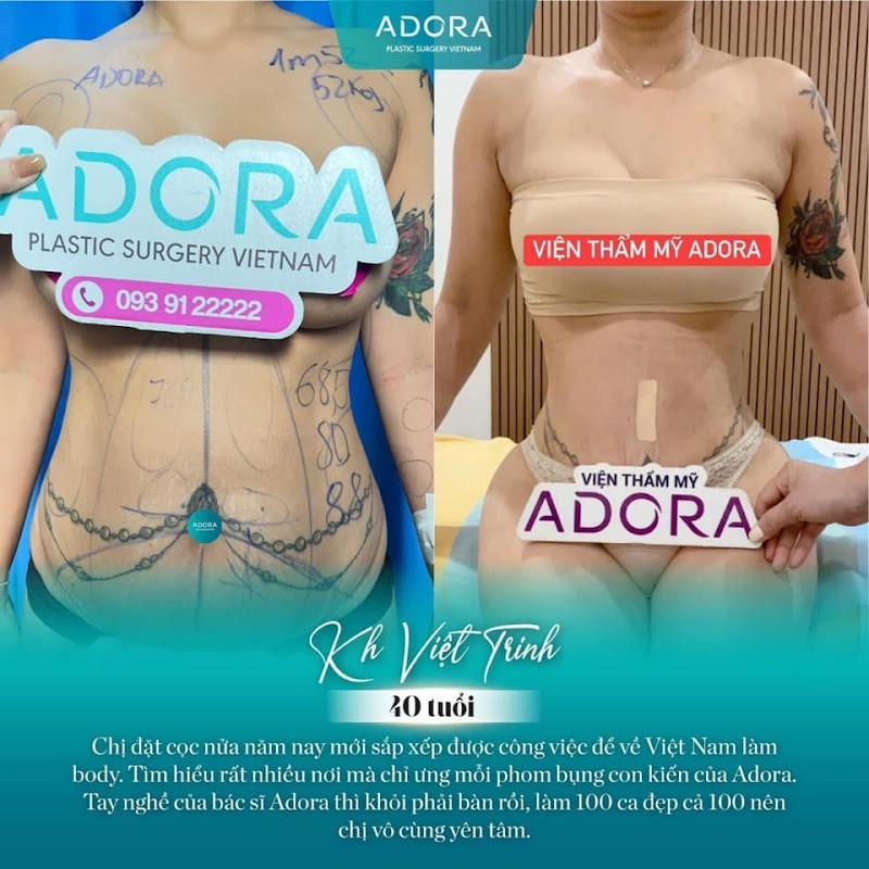 Đẹp An toàn, Tỏa sáng, Bền vững: Bí mật phía sau sự thành công suốt hơn 1 thập kỷ của Adora Plastic Surgery Korea Đẹp An toàn, Tỏa sáng, Bền vững: Bí mật phía sau sự thành công suốt hơn 1 thập kỷ của Adora Plastic Surgery Korea