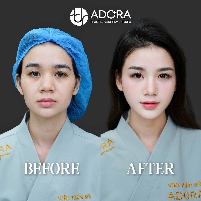 Đẹp An toàn, Tỏa sáng, Bền vững: Bí mật phía sau sự thành công suốt hơn 1 thập kỷ của Adora Plastic Surgery Korea Đẹp An toàn, Tỏa sáng, Bền vững: Bí mật phía sau sự thành công suốt hơn 1 thập kỷ của Adora Plastic Surgery Korea