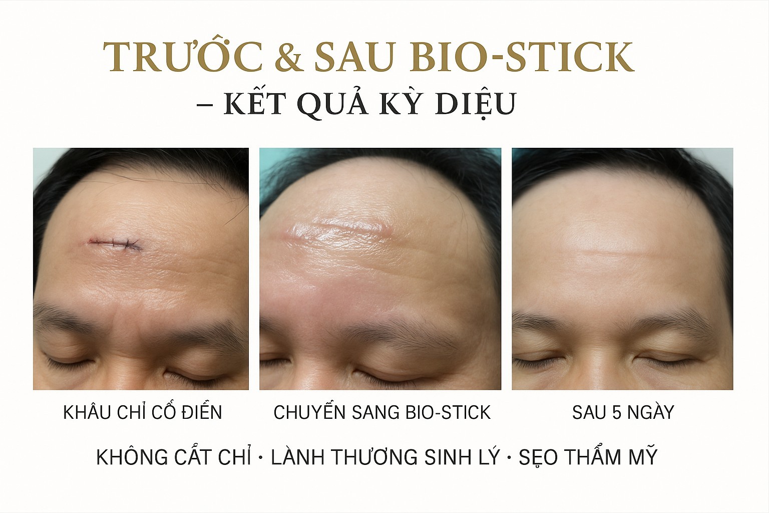 Dr. Phan Sử và ca phẫu thuật thẩm mỹ “không tưởng”: Tự mổ cho chính mình bằng Bio-Stick