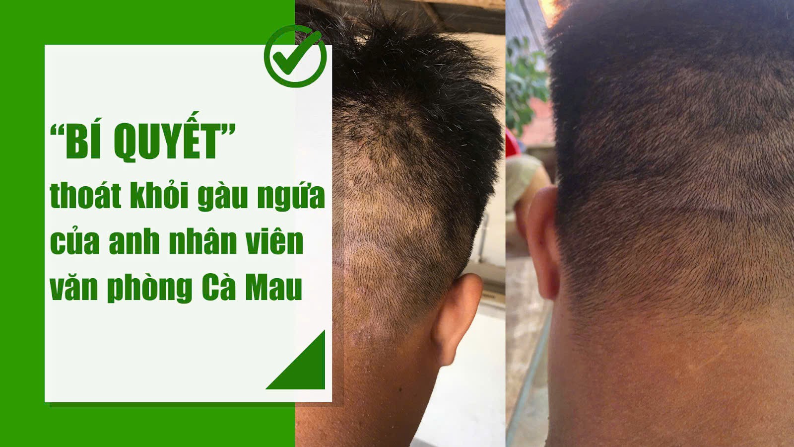 Bí quyết Bí quyết