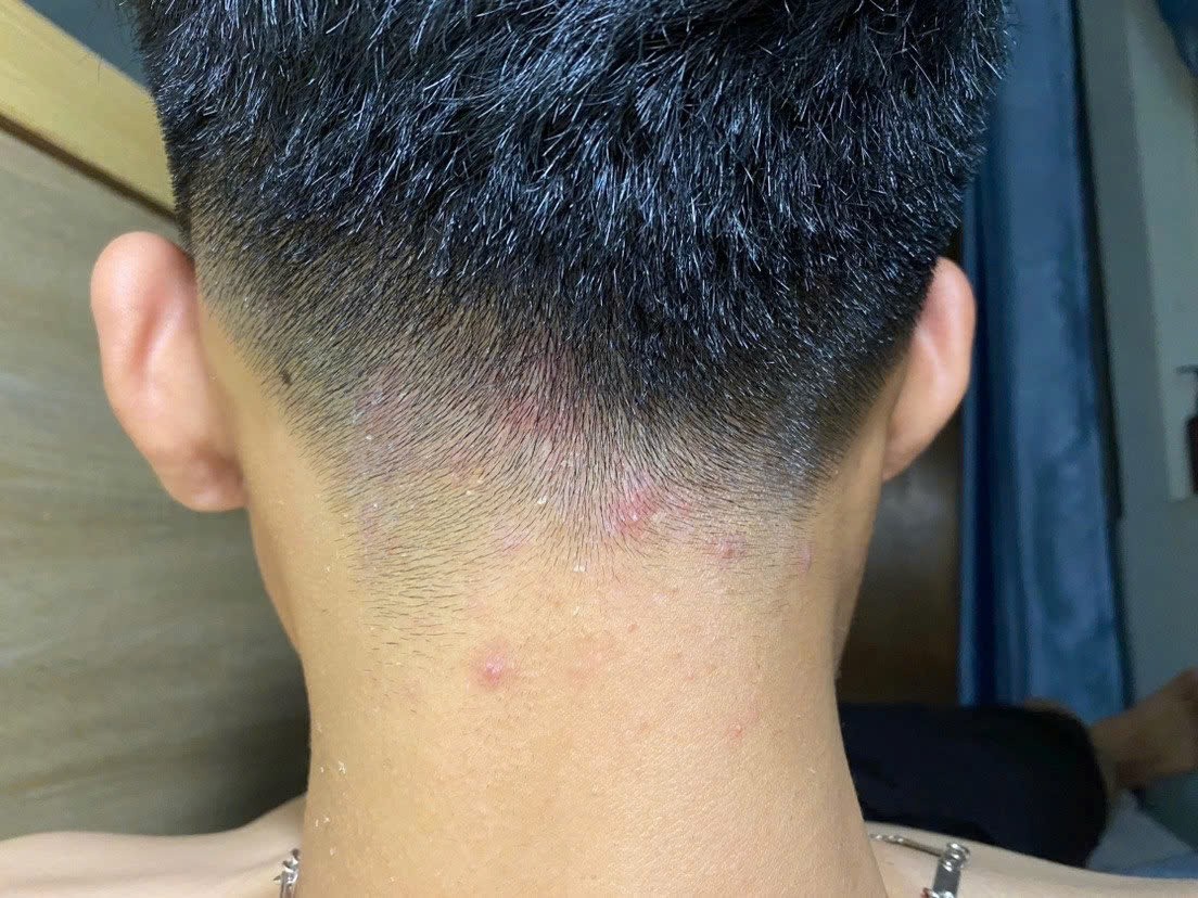 Bí quyết Bí quyết