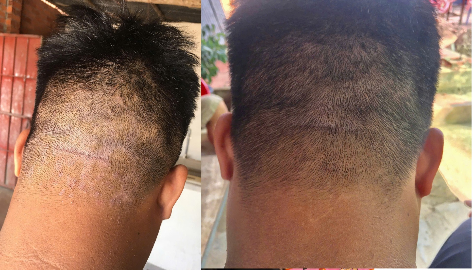 Bí quyết Bí quyết